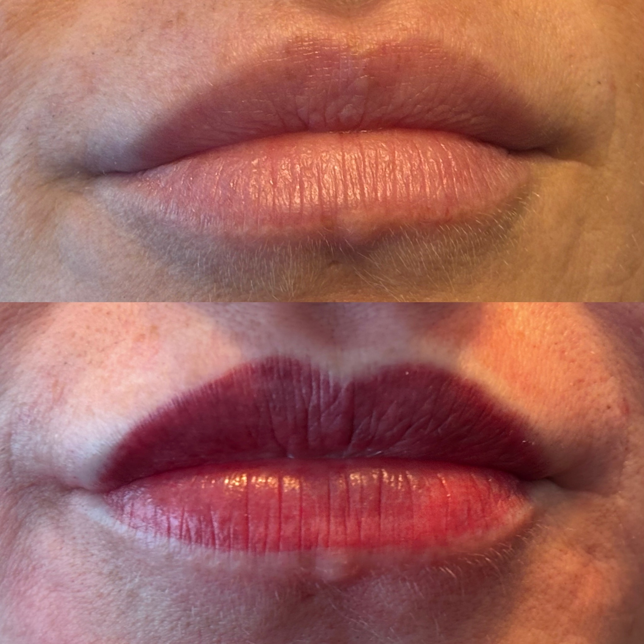 Lippen voor (boven) en na (onder)